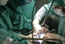 جرمنی میں اعضاء عطیہ کرنے والے کم اور منتظر مریض زیادہ