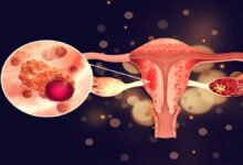 چالیس اور پچاس کی عمر میں خواتین کو رحم کے کینسر کا زیادہ خطرہ کیوں ہوتا ہے؟ کن علامات پر توجی دینا چاہیے